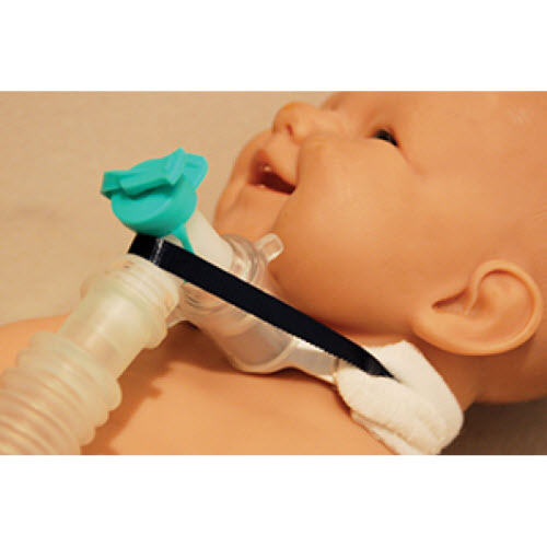 VENT-TIE® Tracheostomy Tube Holders with Ventilator Anti-Disconnect Device