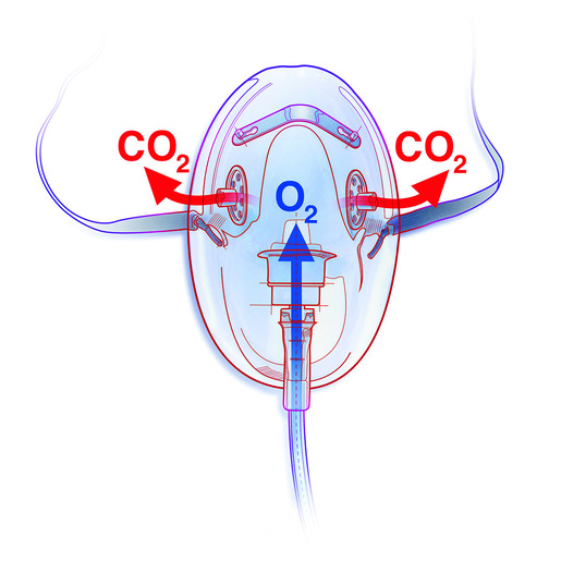 CapnoVue<sup>®</sup> CO2 M1 Masks