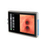 Curaplex® CuraBronch Elite™ HD Video Monitor