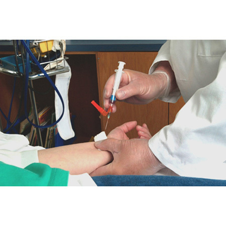 Pulsator Plus Arterial Blood Sampling Kits, Lithium Heparin